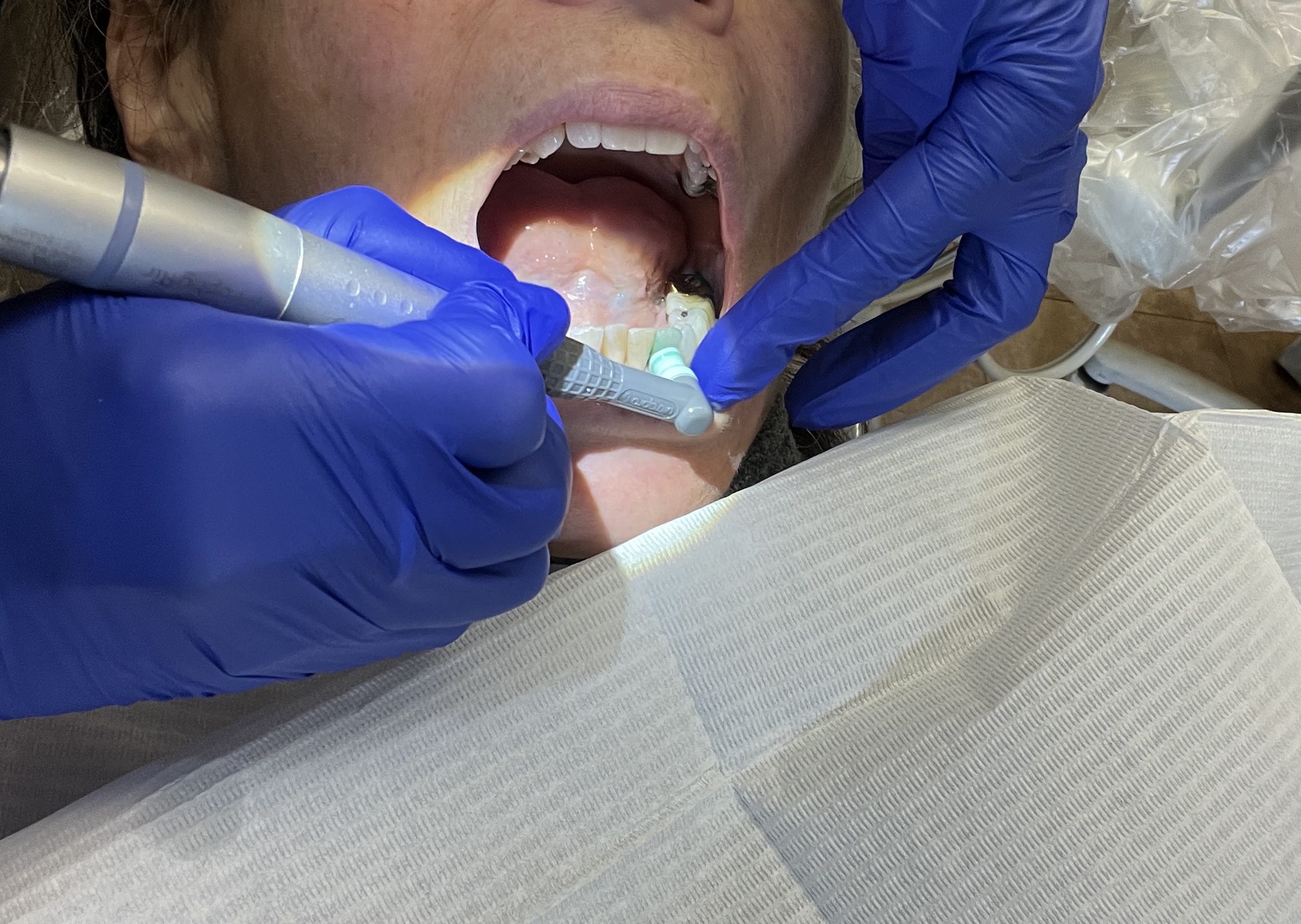 Lawmakers propose higher Medicaid reimbursement rates for NC dentists